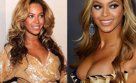 Beyonce-Boob-Job-Breast-Implants-Before-and-After-Photod